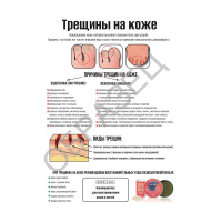Плакат в кабинет мастера - Трещины на коже, электронный макет-файл